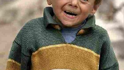 Fazla gülmeleri sakıncalı