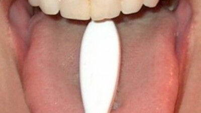 Sarılıktan kurtulmak için dillerini kestiriyorlar