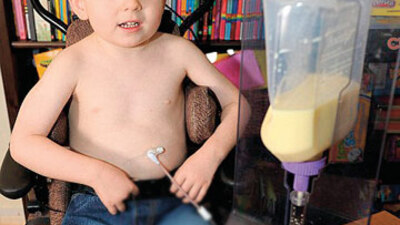 4 yıldır yemek yemiyor