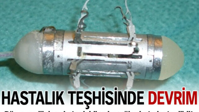 Hastalık teşhisinde devrim!