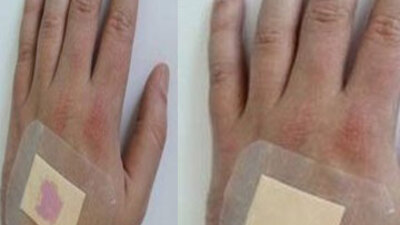 Akıllı yara bandı!