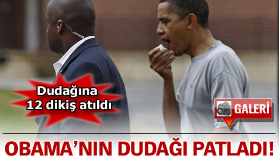 Obama'nın dudağı patladı!