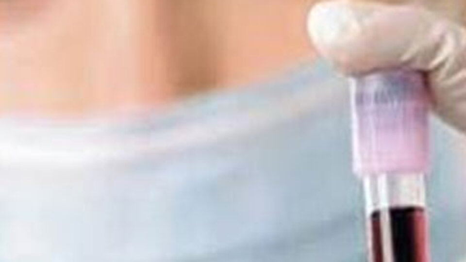 Kalp krizini 6 yıl önceden bildiren test!