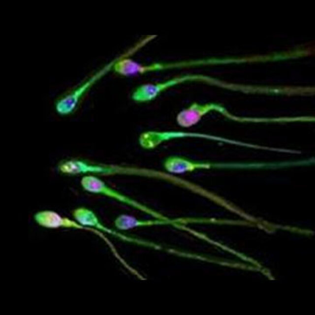 Erkekler! Sperm sayınız düşebilir!