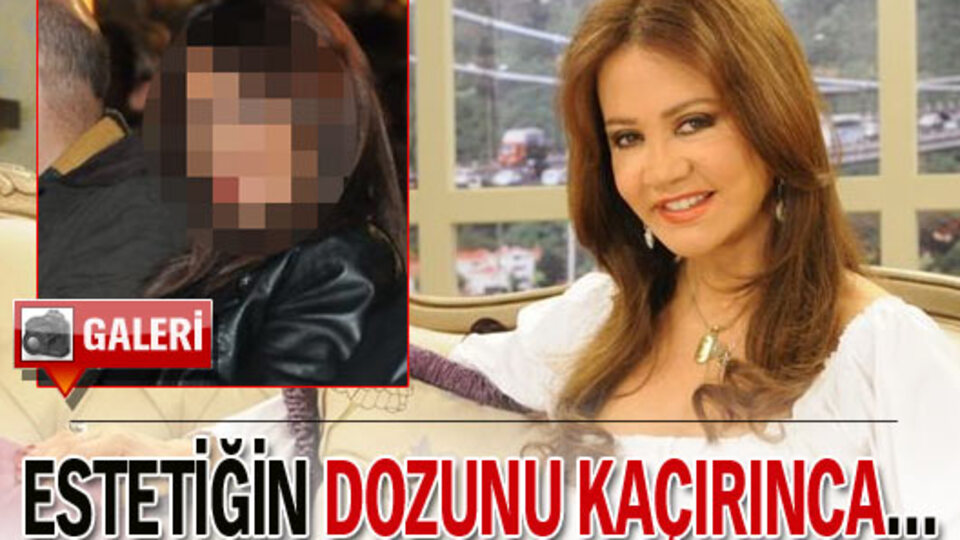 Estetiğin dozunu kaçırınca... GALERİ