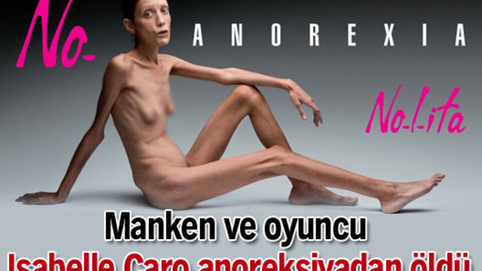 Isabelle Caro anoreksiyadan öldü