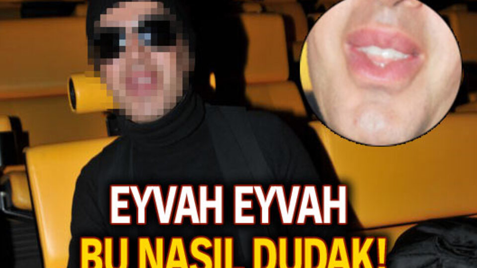 Eyvah eyvah bu nasıl dudak!