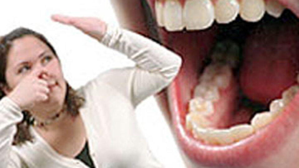 Ağız kokusunu azaltabilecek gıdalar