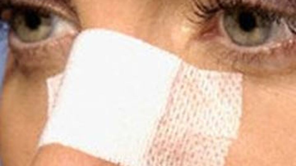 Önce estetik sonra kariyer