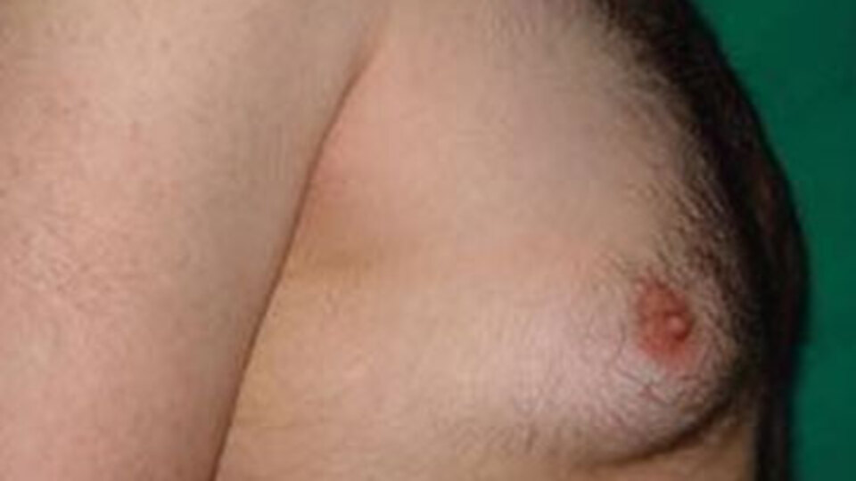 'Yürürken göğüslerim sallanıyor herkesin baktığını sanıyordum'