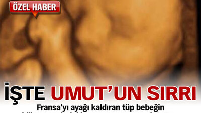 İşte Umut'un sırrı