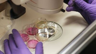 Yapay organ merkezimize kavuştuk