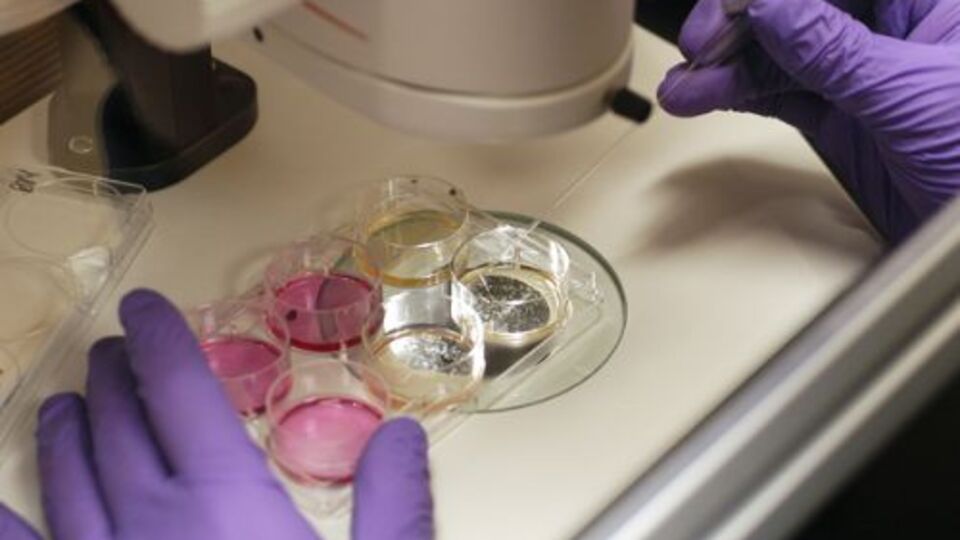 Yapay organ merkezimize kavuştuk