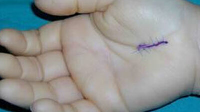 Bilgisayar kullanıcılarını tehdit eden hastalık!