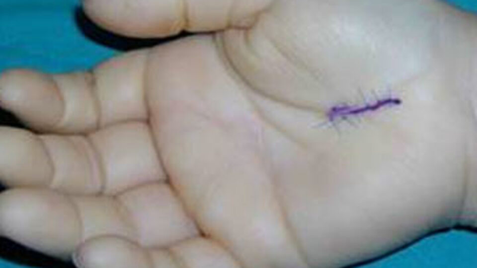 Bilgisayar kullanıcılarını tehdit eden hastalık!