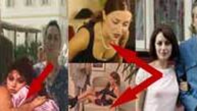 Dizi yıldızlarının şok eden değişimi! GALERİ