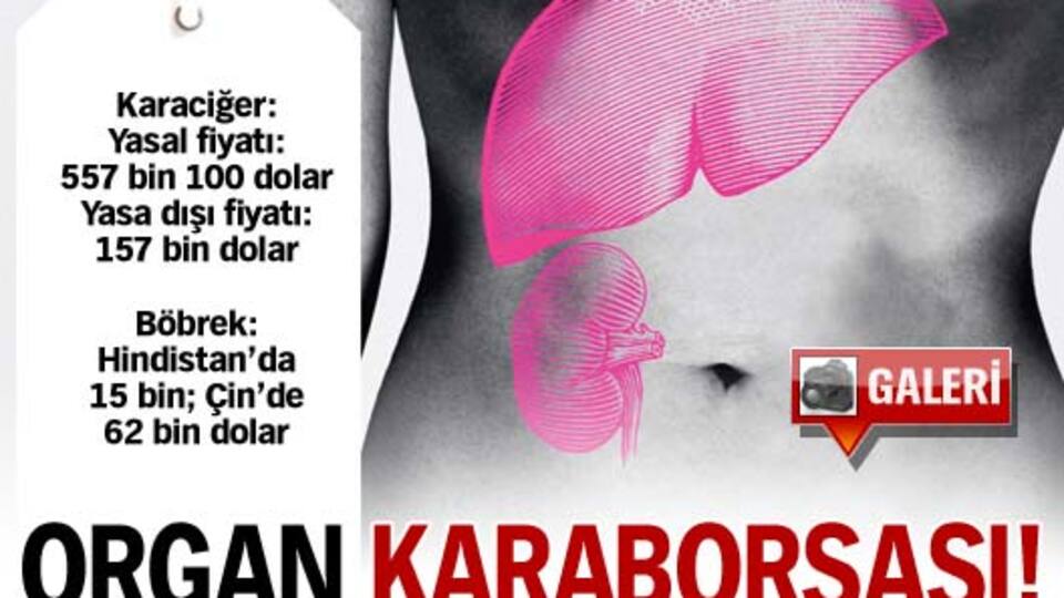 Organ karaborsası