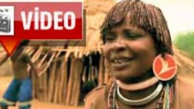 Etiyopyalının kulağına küpe oldu VİDEO