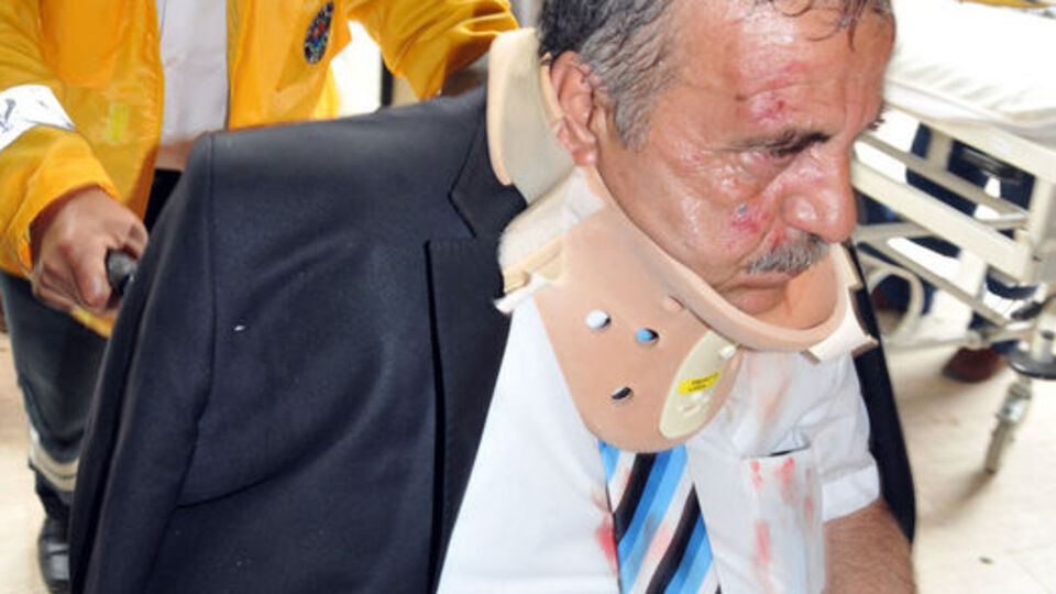 Tur otobüsü devrildi
