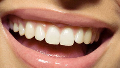 Özgürce gülümsemek için