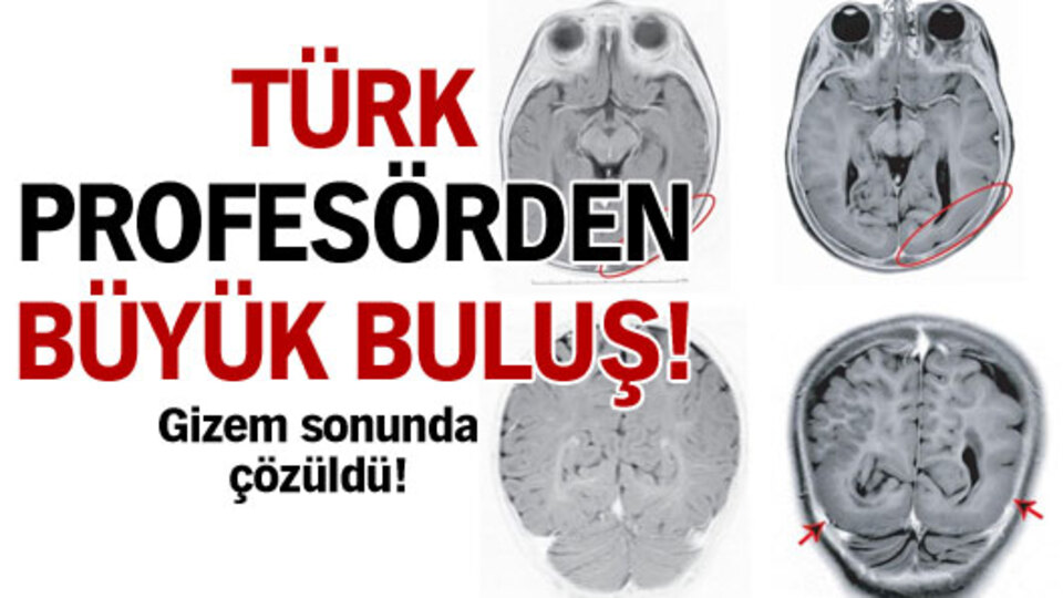 Türk profesörden büyük buluş!