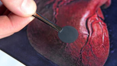 Hasar gören kalbe yara bandı!