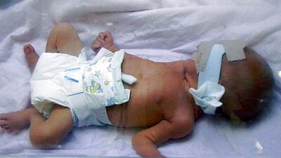 En çok merak edilen konu: Kan uyuşmazlığı