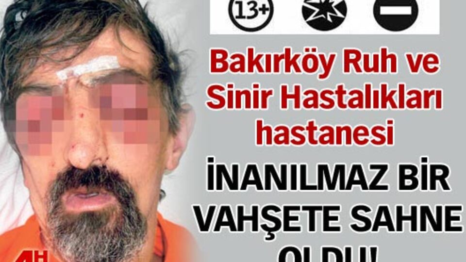 Böyle vahşet görülmedi!