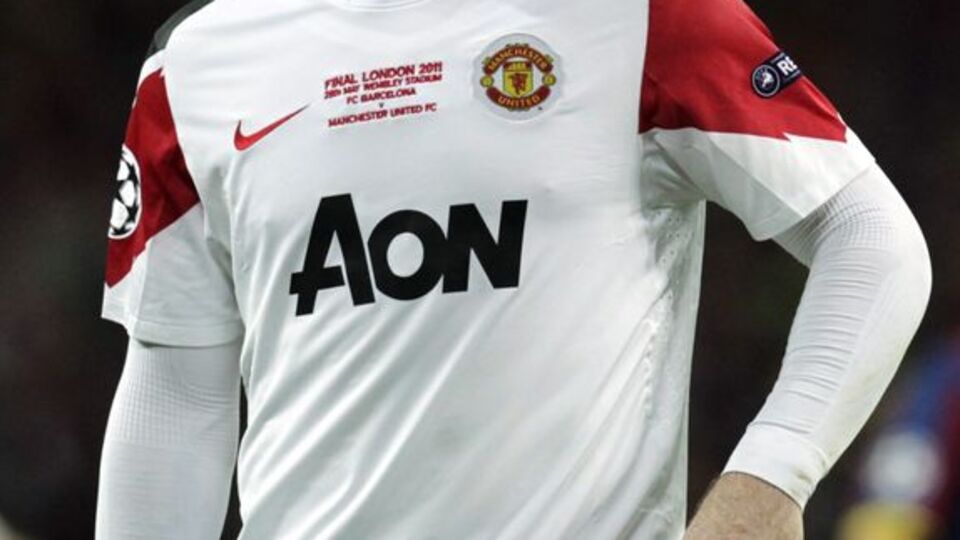 Rooney saç ektirdi!