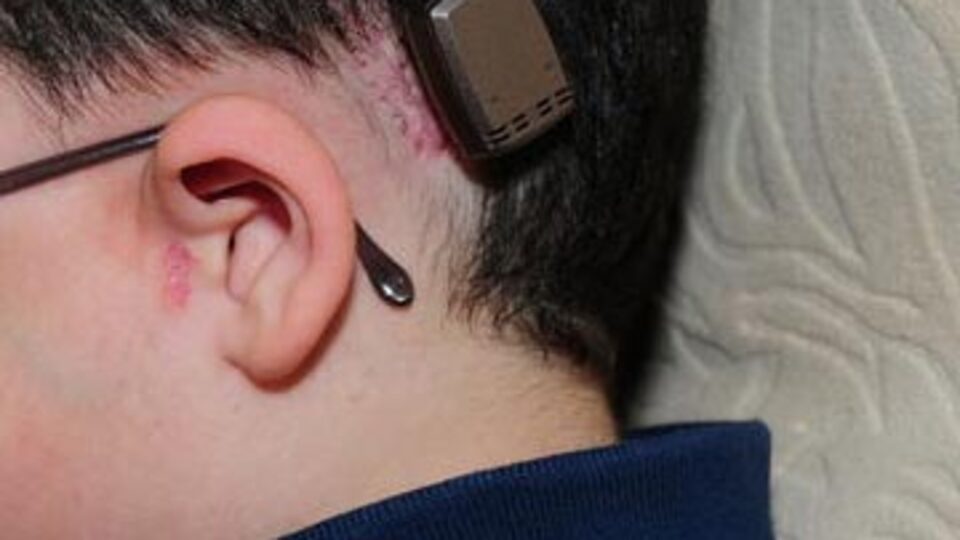 İşitme kaybında doğru cihazı seçmek çok önemli!