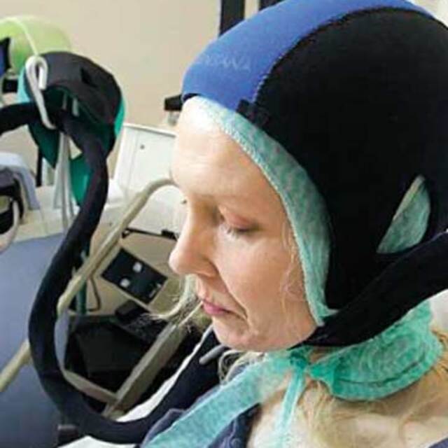 Kemoterapide saç dökülmesine 'buz şapkası'