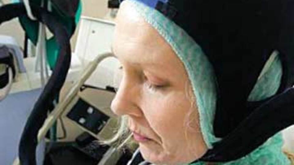 Kemoterapide saç dökülmesine 'buz şapkası'