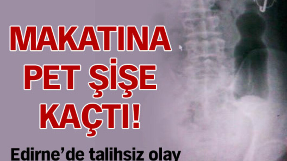 Makatına pet şişe kaçtı!