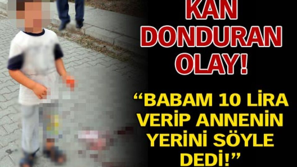 Kan donduran olay!