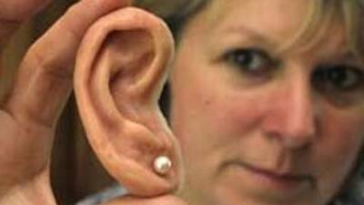 Solaryuma girdi kulağını kaybetti!