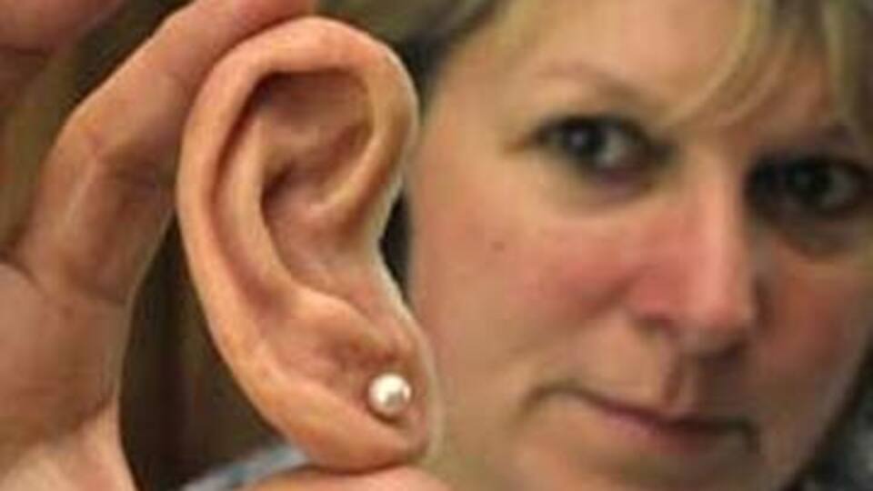 Solaryuma girdi kulağını kaybetti!