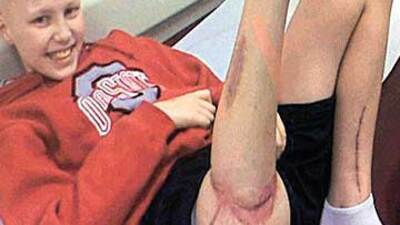 Tedavi için bacağını ters diktiler!