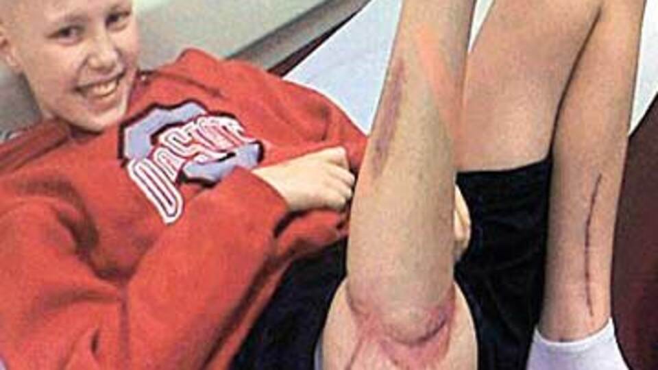 Tedavi için bacağını ters diktiler!