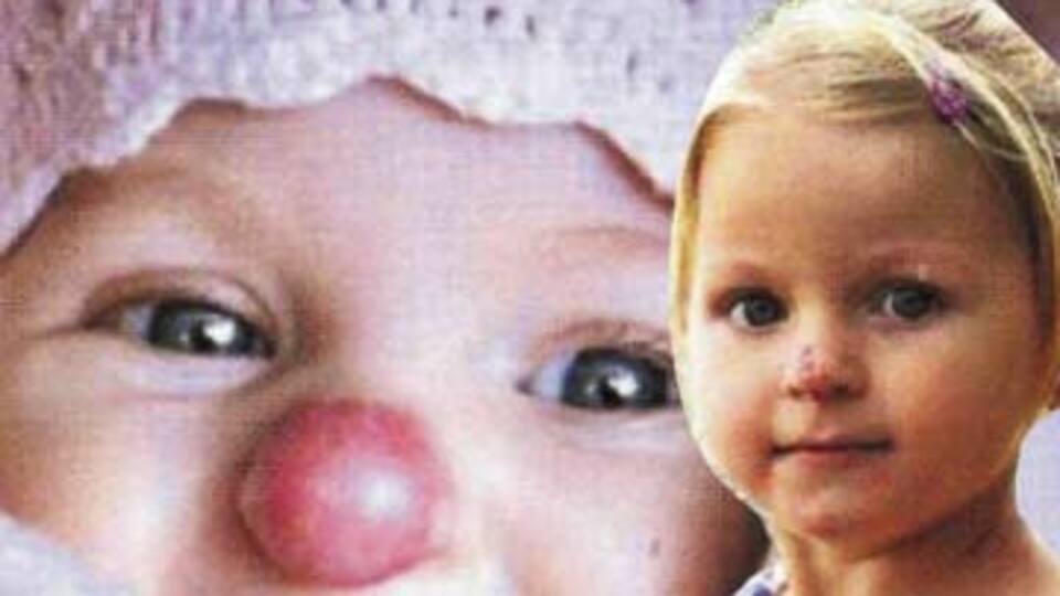 Palyaço burundan ameliyatla kurtuldu!