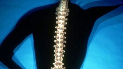 D vitaminine dikkat!