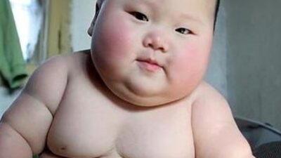 Tombul bebek sağlıklı değil