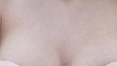 Genç kızlar göğüslerini büyütmek istiyor