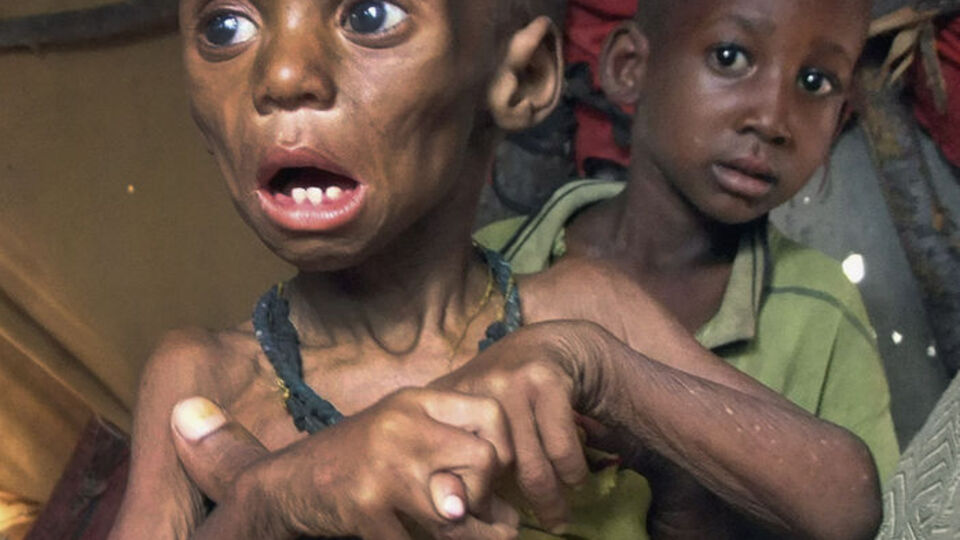 "Doğu Afrika'da çocuklar kitleler halinde ölebilir"