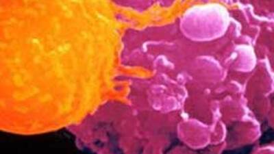 Kansere dev bütçe!