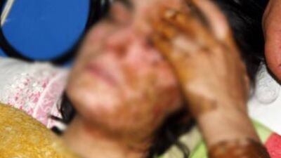 Kezzabı kocası atmamış!