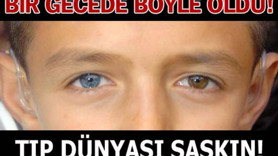 Bir gecede böyle oldu!