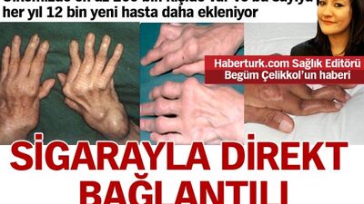 Sigarayla direkt bağlantılı!