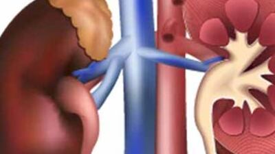 5 yıllık maliyeti 120 bin dolar