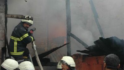 Sigaradan önce bacağını sonra hayatını kaybetti GALERİ