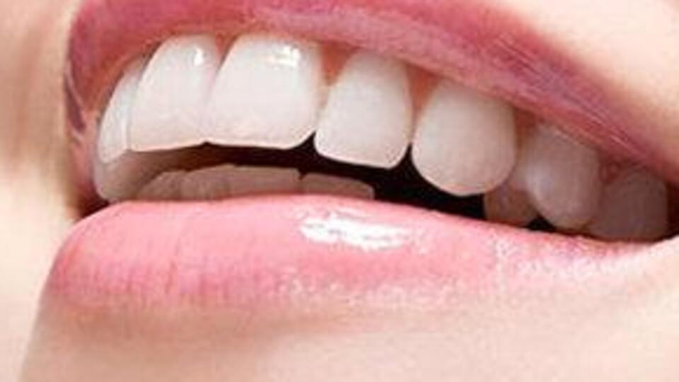 Yerli üretim yapay diş kökü